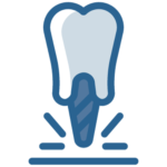 Implante Dentário